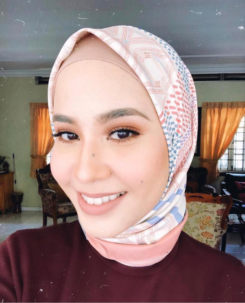 [GAMBAR] Amboi...Ini Antara Artis Wanita Yang Ada Tahi Lalat Di Wajah