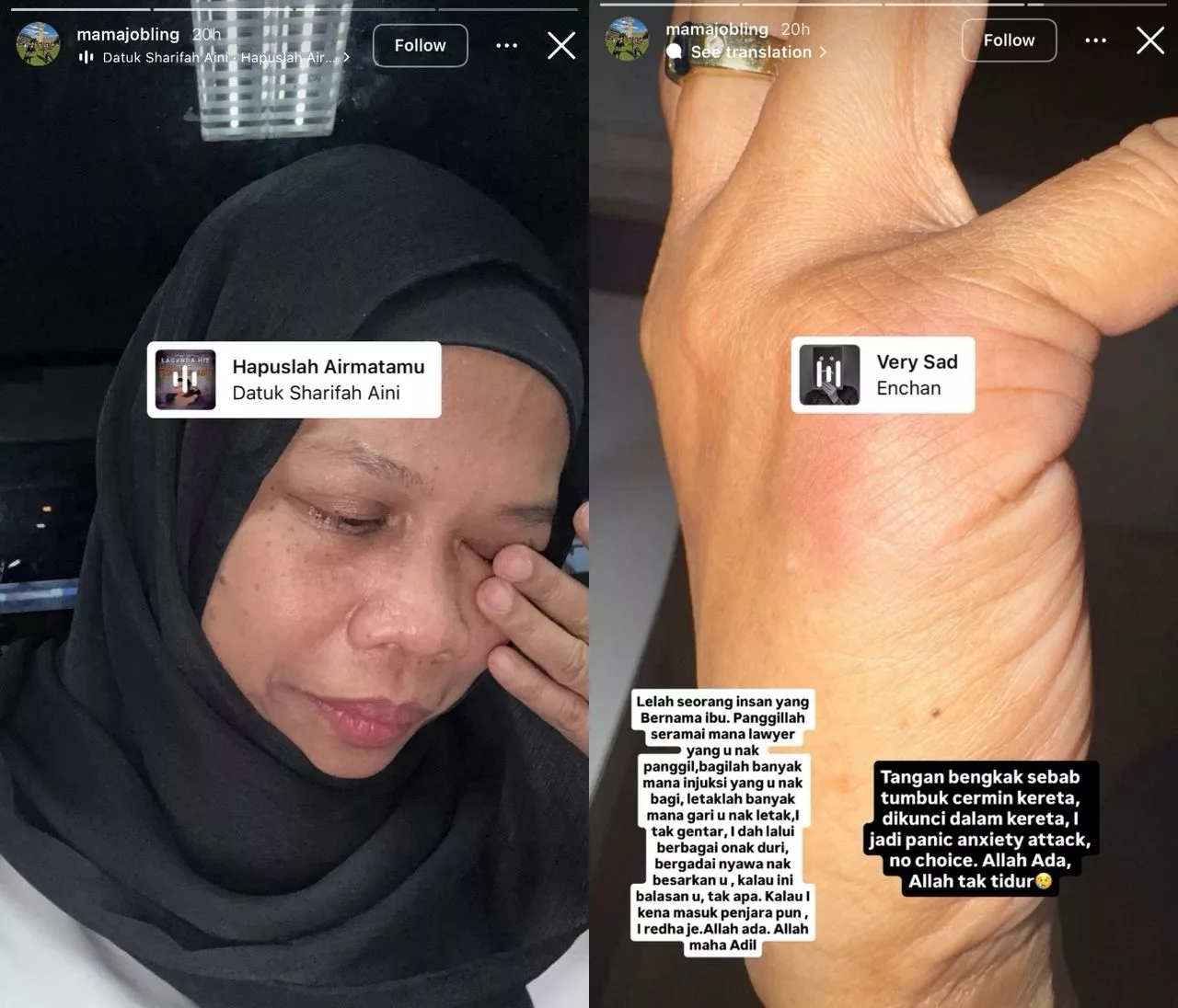 “Saya Sudah Lalui Berbagai Onak Duri, Bergadai Nyawa Nak Besarkan Awak. Kalau Ini Balasan…,” – Ibu Anna Jobling