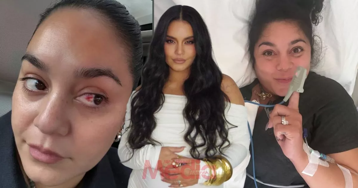 Vanessa Hudgens Kongsi Pengalaman Pembuluh Darah Mata Pecah Ketika Bersalin