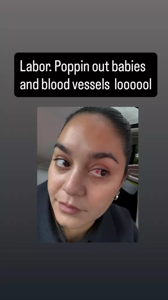 Vanessa Hudgens Kongsi Pengalaman Pembuluh Darah Mata Pecah Ketika Bersalin
