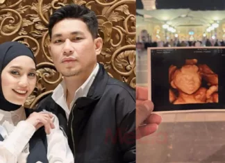 Anak Keempat Rizal Armada Meninggal Dunia Dalam Kandungan