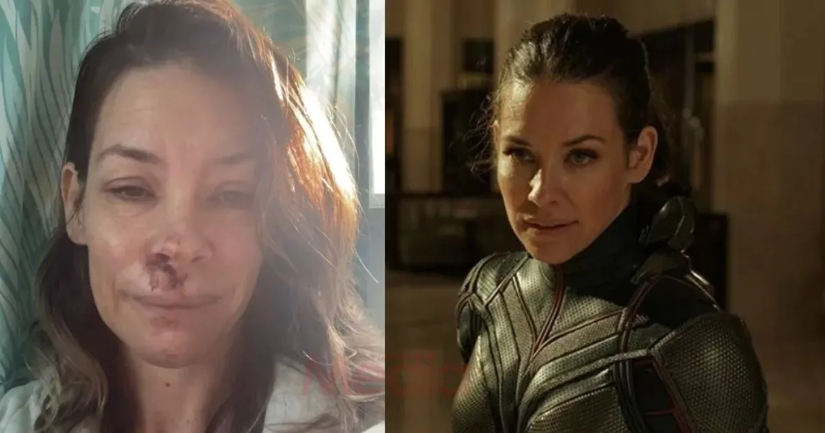 "Masuk Tahun Baru Dengan Berita Buruk," - Pelakon Marvel Alami Kecederaan Otak, Alami Penurunan Fungsi Kognitif 20 "Masuk Tahun Baru Dengan Berita Buruk," - Pelakon Marvel Alami Kecederaan Otak, Alami Penurunan Fungsi Kognitif