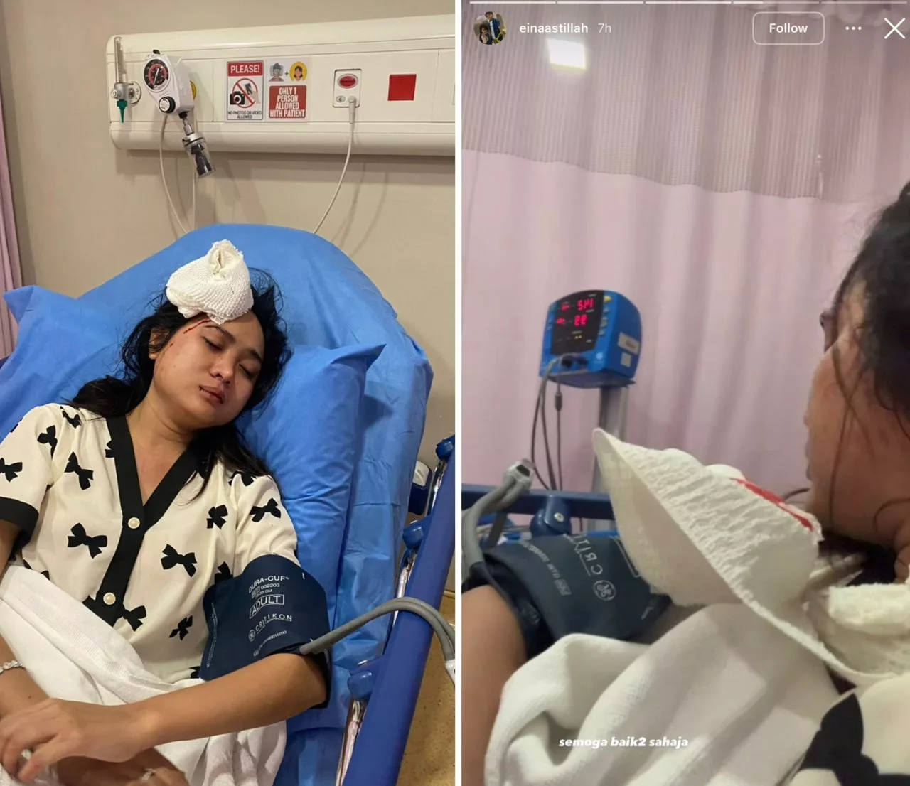 “Semoga Baik-Baik…,” – Didi Astillah Cedera Dikhabarkan Jatuh Tangga Hingga Berdarah Dahi & Dikejarkan Ke Hospital