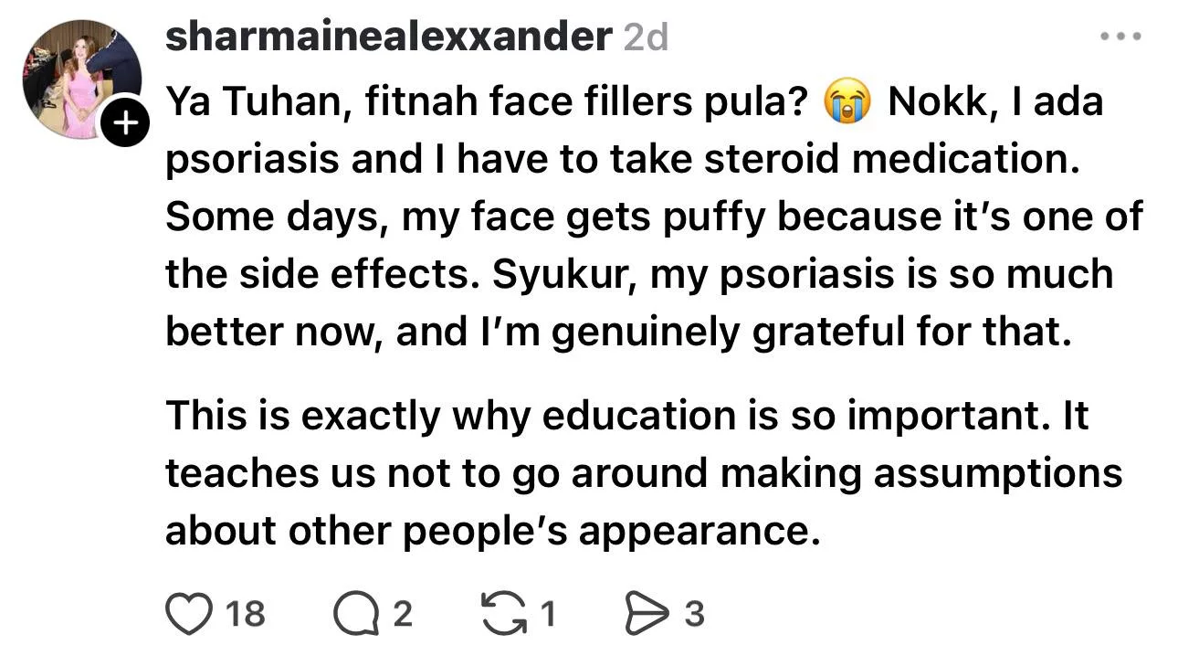 “Ya Tuhan, Fitnah…,” - Sharmaine Alexender Nafi Buat ‘Face Filler’, Wajah Berubah Sebab Kesan Ubat Psoriasis