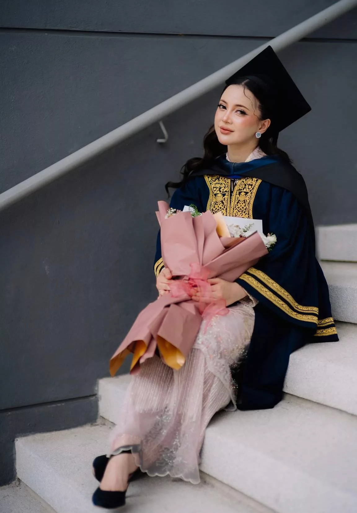 “Ya Tuhan, Fitnah…,” - Sharmaine Alexender Nafi Buat ‘Face Filler’, Wajah Berubah Sebab Kesan Ubat Psoriasis