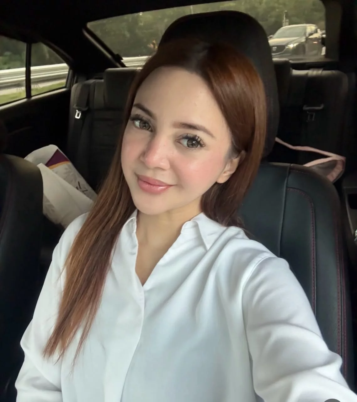 “Tersinggung Itu Tidak, Tapi…,” - Sharmaine Alexander Dedah Perjuangan Lawan Psoriasis Sampai 2 Bulan Tak Keluar, Hargai Dedikasi Fasha Sandha