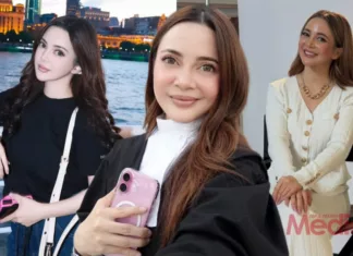 “Tersinggung Itu Tidak, Tapi…,” – Sharmaine Alexander Dedah Perjuangan Lawan Psoriasis Sampai 2 Bulan Tak Keluar, Hargai Dedikasi Fasha Sandha