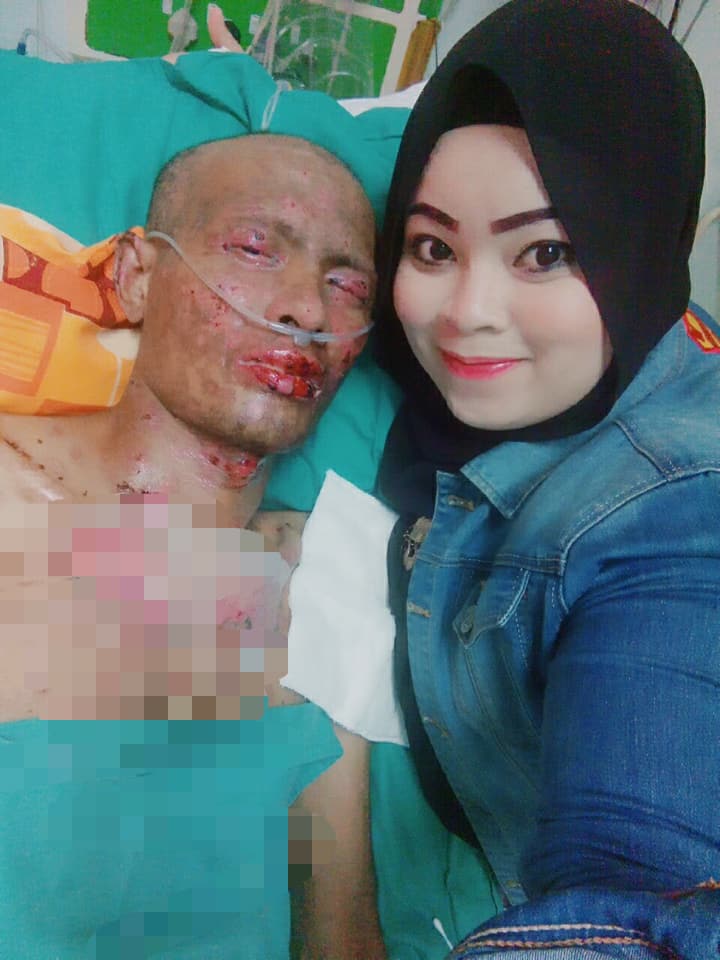 'Orang Tanya Kenapa Tutup Muka Suami' Wanita Tabah Jawab 